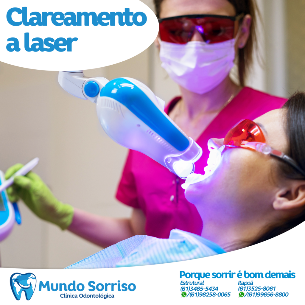 Clareamento a laser 2
